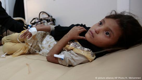 Yemen Cholera Cases Leap Above 300 000 DW 07 11 2017