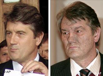 دو تصوير از يوشچنكو، رهبر اپوزيسيون اوكرايين پيش و پس از مسموميت احتمالى از دى‌اكسين