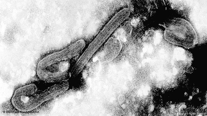 Wie Gefahrlich Ist Das Marburg Fieber In Westafrika Wissen Umwelt Dw 10 08 2021