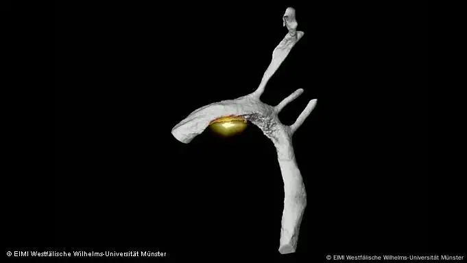 Eine Mäuse-Aorta, die in einem Computertomographen sichtbar gemacht wurde. Darauf ist auch eine vaskuläre Entzündung der Blutgefäße erkennbar. Diese wurde durch eine Nano-Behandlung mit radioaktiven Inhibitoren für entzündungshemmende Matrix-Metalloproteasen sichtbar gemacht. (Quelle: Hermann S, Ropinski T, Schäfers M, Sonderforschungsbereich 656 Molekulare kardiovaskuläre Bildgebung , European Institute for Molecular Imaging - EIMI Westfälische Wilhelms-Universität Münster)