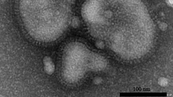 Electron micrograph of the H5N1 virus