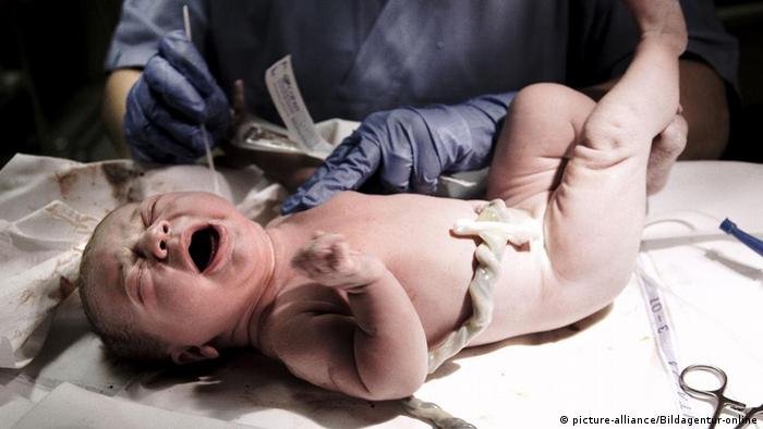 Seorang bayi beberapa saat setelah lahir, dengan tali pusar masih menempel