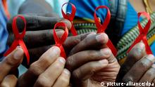 SIDA é a principal causa de morte entre moçambicanos em idade ativa 