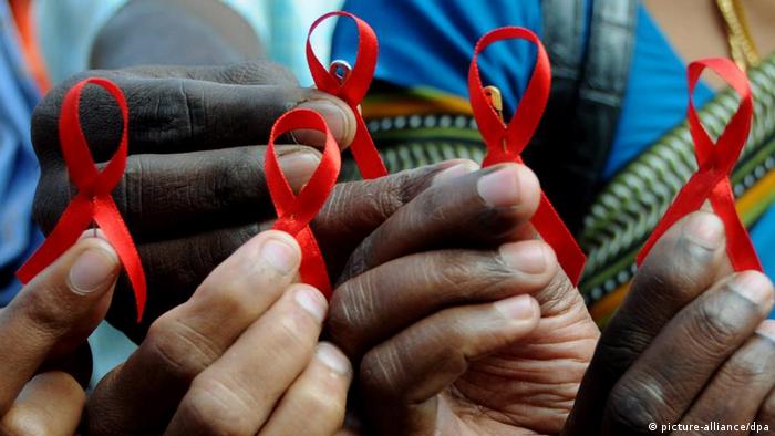 Hingga kini penyakit aids belum ada obatnya penelitian dilakukan oleh para ahli untuk mengetahui aktivitas virus hiv pada tingkat organisasi kehidupan yaitu