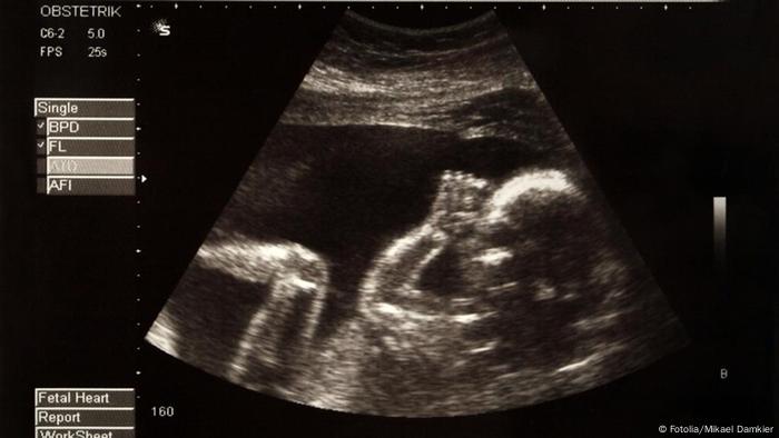 Five Pathogens That Can Harm An Unborn Child Science In Depth Reporting On Science And Technology Dw 31 01 2016
