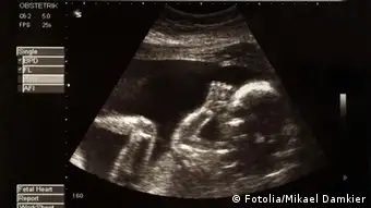 Ultraschalluntersuchung in der Schwangerschaft