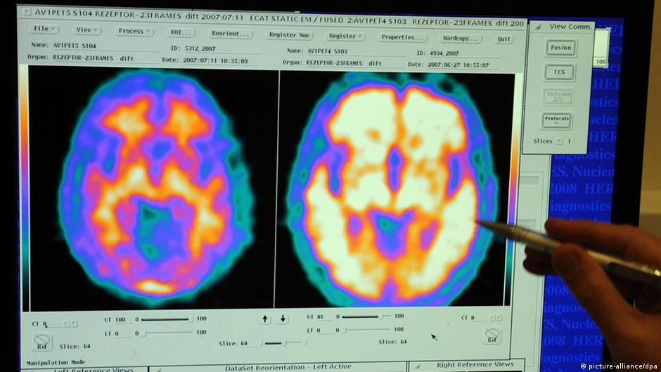 Medical Technology in Germany explores new paths DW 05/19/2015