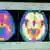 Monitor s prikazom aktivnih dijelova mozga