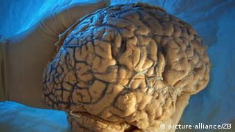 حجم لایه خاکستری مغز معتادان با سرعت بیشتری تحلیل می‌رود