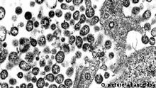 Die undatierte elektronenmikroskopische Aufnahme zeigt Lassaviruspartikel aus Zellkulturen, gezüchtet am Bernhard-Nocht-Institut für Tropenmedizin in Hamburg. Das Lassavirus gehört zur Familie der Arenaviren, deren Namen sich von lateinisch arena= Sand ableitet. Namensgebend sind die körnigen Strukturen, die in den Viruspartikeln zu erkennen sind. Es handelt sich dabei um Zellbestandteile, Ribosomen, die das Virus aus der Wirtszelle mitnimmt. Der Zustand des an Lassa-Fieber erkrankten Afrikaners in der Frankfurter Universitätsklinik war auch am Montagmorgen (24.07.2006) unverändert kritisch. Foto: Bernhard-Nocht-Institut für Tropenmedizin (BNI)/Tropeninstitut Hamburg dpa/lno nur s/w +++(c) dpa - Report+++ dpa 8773279