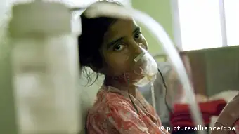 TBC Tuberkulose Frau Patientin Indien - Jasmin Begum, 28 Jahre, ist multiresistent an TBC erkrankt und wiegt nur noch 27 Kilogramm. Sie befindet sich auf der Quarantänestation des St. Thomas' Homes in Howrah. Mit viel Glück ist sie nach einer eineinhalb- bis dreijährigen Therapie wieder gesund. Das St. Thomas' Home ist eine Spezialklinik der Hilfsorganisation Ärzte für die dritte Welt und der nordindischen Kirche für tuberkulosekranke Frauen. Sie liegt in der Großstadt Howrah im Großraum Kalkutta. (Aufnahme vom August 2007). Foto: Denis Meyer +++(c) dpa - Report+++ Schlagworte Frau, Patientin, Tuberkulose, Tb, Tbc, krank, Atemmaske, sauerstoffmaske, Gesundheit, Gesellschaft, Krankenhäuser, Patienten, Krankheiten, Frauen, Medizin, Gesundheitswesen, Armut