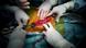 Organtransplantation Organspende Operation Nierentransplantation Organtransplantation Organspende Operation Nierentransplantation