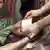 Eine Kranke Tschetschenin wird mit einer kalten Kompresse behandelt (Foto: picture-alliance/dpa)
