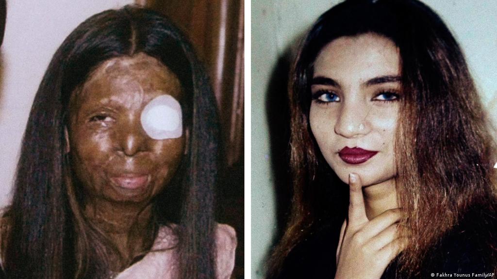Oscar-winning acid attack film sparks 
