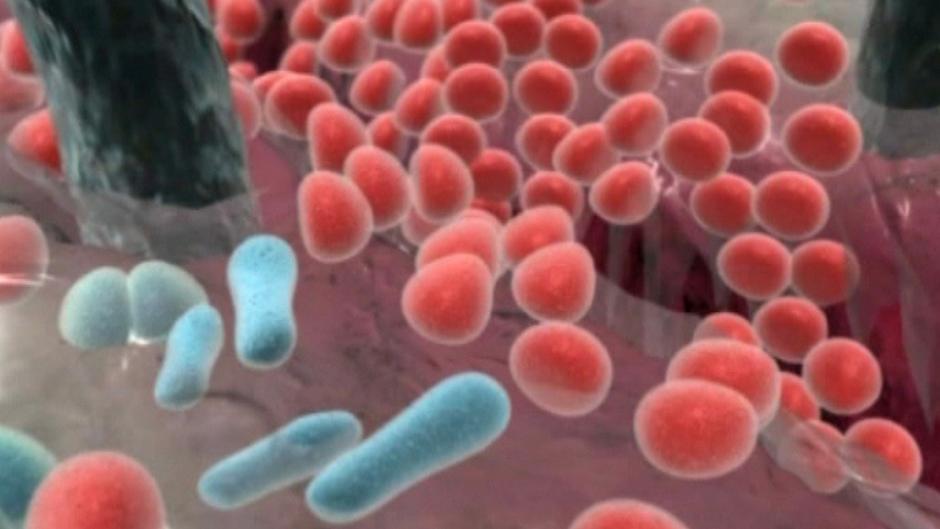 البكتيريا في أمعاء جسم الإنسان وظائف حيوية وأنواع لا حصر لها علوم وتكنولوجيا آخر الاكتشافات والدراسات من Dw عربية Dw 20 11 2012