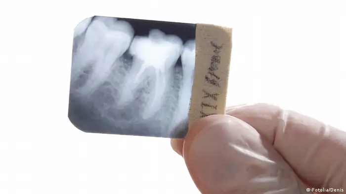 Röntgenbild von einem Zahn (Foto: Fotolia/Denis).