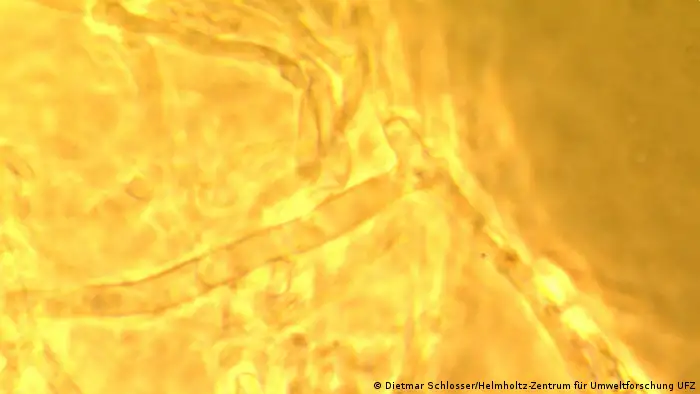 Micelio bajo el microscopio.