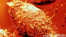 Vorgänge während der Infektion werden an Zellen untersucht, die außerhalb des Körpers in Kulturschalen vermehrt werden. Sie sind relativ leicht manipulierbar, und der Infektionsprozess kann in seinen einzelnen Schritten präzise analysiert werden. Hier haben sich zahlreiche Neisserien, die Erreger der Gonorrhoe (Tripper), an die Oberfläche einer Epithelzelle angeheftet; sie sind im Begriff, in die Zelle einzudringen. Epithelzellen sind die oberste Schicht des menschlichen Haut-und Schleimhautgewebes; Epithelgewebe bedeckt als Zellverband zum Beispiel zahlreiche Organe im Körperinneren. Aufnahme von 2001. Kolorierte, rasterelektronenmikroskopische Aufnahme. Da die Untersuchung im Hochvakuum stattfindet, wurde die Zelle in einem speziellen Verfahren ohne zu kollabieren getrocknet und zur Stabilisierung mit einer einhunderttausendstel Millimeter dicken Goldschicht bedampft.