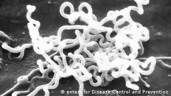 Treponema pallidum, bacteria transmisora de la sífilis.