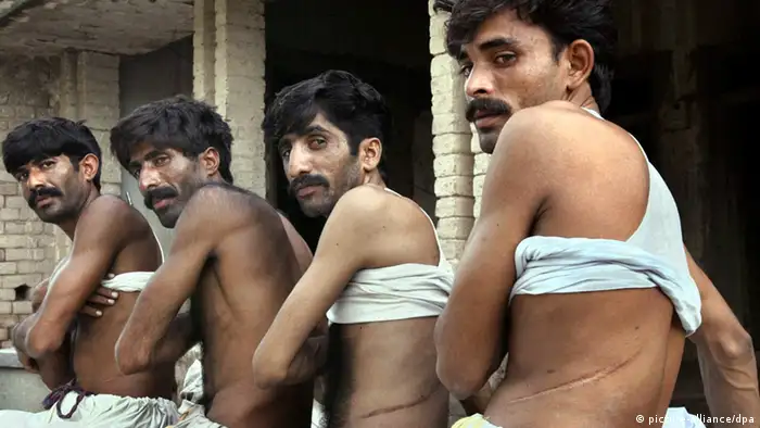A photo dated Wednesday, 11 August 2004 of Kidney Sellers Association Chairman, 25-year-old Pakistani Iqbal Zafar (3R) and three other villagers, showing their scars after they each sold a kidney to pay off debts in Sultan Pur, Pakistan. So-called 'low-cost' workers live under Pakistan's rural feudal system and sell a kidney to a middleman for less than 1,400 euros. Afterwards, they often suffer weakness and constipation while daily medical costs of about 3 euros forces them into fresh debt. The kidney trade has become increasingly popular and, attracted by commission, victims often become middlemen for family and friends. Foto:Olivier Matthys/EPA dpa