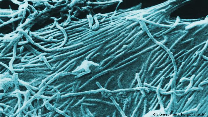 virusi ebola tratarea paraziților a copiilor
