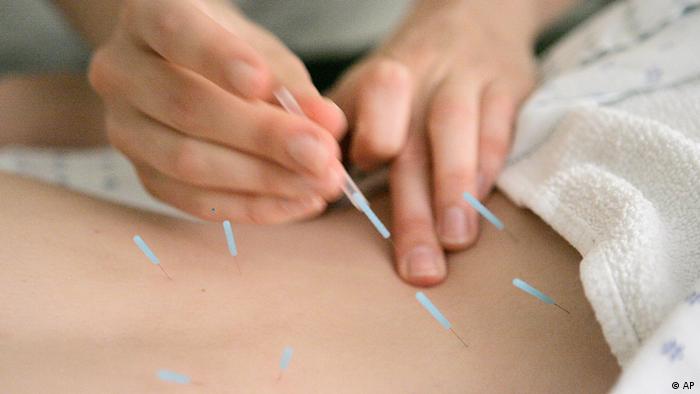 Primer plano de agujas de acupuntura.