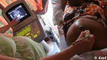 Sudáfrica: Esterilizadas sin permiso por estar embarazadas y portar el VIH