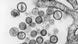 Ein mikroskopischer Blick auf Partikel des Hantavirus (Foto: rtr) Ein mikroskopischer Blick auf Partikel des Hantavirus (Foto: rtr)