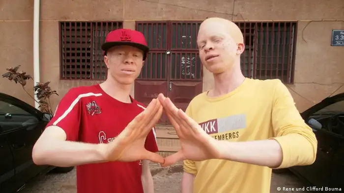 Les Camerounais René et Clifford Bouma font du rap pour appeler à plus de tolérance envers les albinos