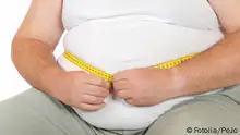تحويل مجرى الشريان التاجي خطر على البدناء