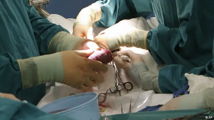 Symbolbild Transplantation Organspende-Kontrolle