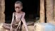 An emaciated young victim of nodding disease sits in front of a hut ( XINHUA /LANDOV) An emaciated young victim of nodding disease sits in front of a hut ( XINHUA /LANDOV)