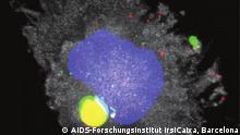 Descubren puerta de entrada del virus del VIH/SIDA a las células