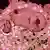 Раковые клетки под микроскопом