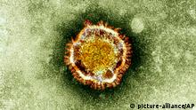 Krebs-Wirkstoff AM580: Kommt das Anti-Viren-Medikament? 