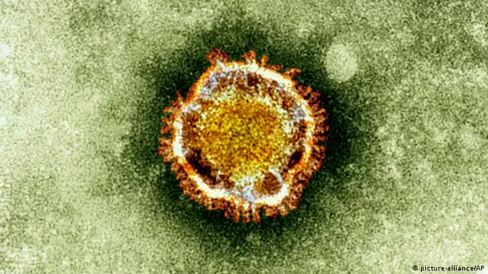 This undated image released by the British Health Protection Agency shows an electron microscope image of a coronavirus, part of a family of viruses that cause ailments including the common cold and SARS, which was first identified last year in the Middle East. British officials say a mysterious virus related to SARS may have spread between humans, as they confirmed the 11th case worldwide of the new coronavirus in a patient who they say probably caught it from a family member. Officials at the World Health Organization said the new virus has probably already spread between humans in some instances. (AP Photo/Health Protection Agency)