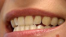 مشكلة صرير الأسنان وتأثيرها على أوجاع الرأس والمفاصل!