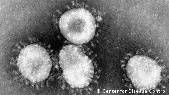 ARCHIV - HANDOUT - Das Handout des amerikanischen Centers for Disease Control (CDC) zeigt ein Coronavirus unter dem Mikroskop. (Aufnahme vom April 2003). Foto: Center for Disease Control/epa/dpa (ACHTUNG: Nur zur redaktionellen Verwendung und bei vollständiger Nennung der Quelle: «Center for Disease Control»; zu dpa «Weitere Coronavirus-Fälle in Saudi-Arabien - Verdacht in Frankreich» vom 10.05.2013) +++(c) dpa - Bildfunk+++