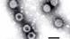 English: Note the wheel-like appearance of some of the rotavirus particles. The observance of such particles gave the virus its name ('rota' being the Latin word meaning wheel). Bar = 100 nanometers. Source: Cell culture. Method: Negative-stain Transmission Electron Microscopy Date Source http://www.epa.gov/microbes/rota.html Author F.P. Williams, U.S. EPA This image (or other media) is a work of an Environmental Protection Agency employee, taken or made as part of that person's official duties. As works of the U.S. federal government, all EPA images are in the public domain. http://commons.wikimedia.org/wiki/File:Rotavirus.jpg English: Note the wheel-like appearance of some of the rotavirus particles. The observance of such particles gave the virus its name ('rota' being the Latin word meaning wheel). Bar = 100 nanometers. Source: Cell culture. Method: Negative-stain Transmission Electron Microscopy Date Source http://www.epa.gov/microbes/rota.html Author F.P. Williams, U.S. EPA This image (or other media) is a work of an Environmental Protection Agency employee, taken or made as part of that person's official duties. As works of the U.S. federal government, all EPA images are in the public domain. http://commons.wikimedia.org/wiki/File:Rotavirus.jpg