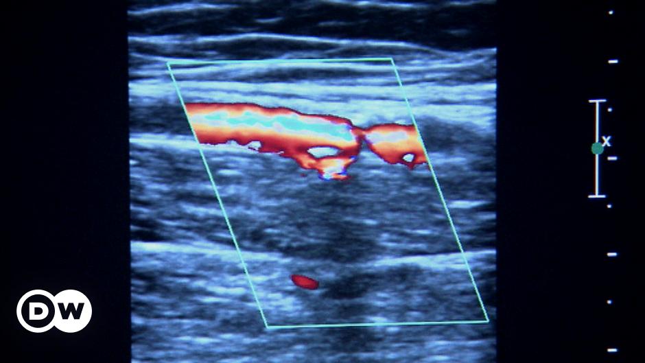 في ألمانيا علاج تصلب الشرايين بدون تدخل جراحي علوم وتكنولوجيا آخر الاكتشافات والدراسات من Dw عربية Dw 14 07 2013