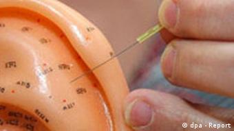 Alternative Heilmethode Akupunktur