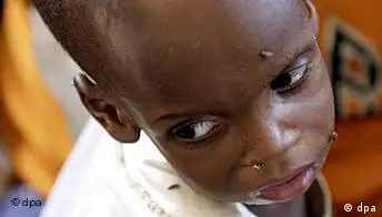 Freies Bildformat: Hunger in Afrika, unterernährtes Kind in Niger