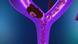 16.10.2013 DW Fit und Gesund Thrombose 16.10.2013 DW Fit und Gesund Thrombose