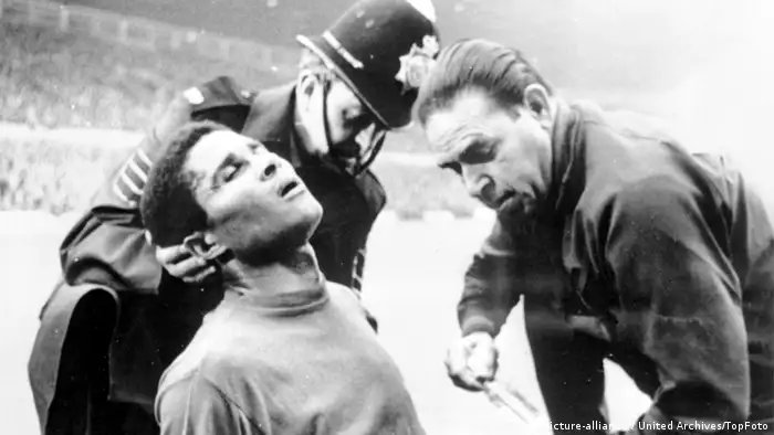 Eusebio wird im Spiel gegen Ungarn am 13. Juli 1966 am Kopf behandelt (Foto: picture-alliance / United Archives/TopFoto)