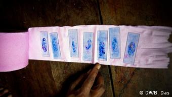 Tuberculosis cultures on slides laid out along a roll of toilet paper (Photo: DW/ Bijoy)