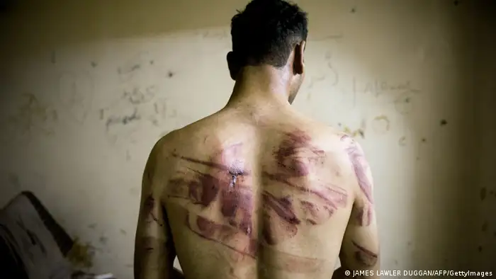 Syrien Folter Mißbrauch Symbolbild MIT BEDACHT VERWENDEN