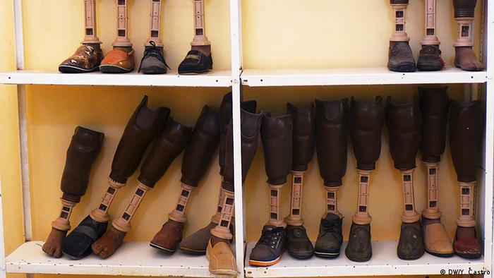 Rows of prosthetic legs and feet