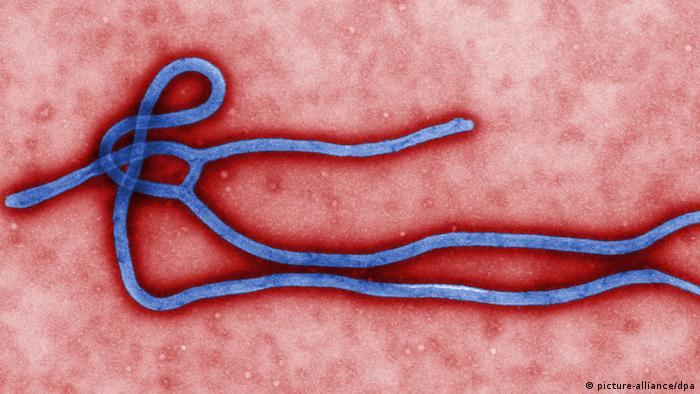 Ebola Virus Photo: Cynthia Goldsmith/CDC