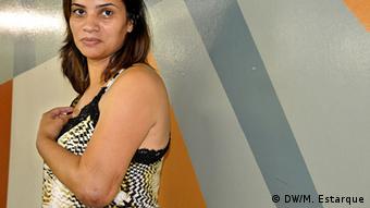 Scarred elbow of a domestic violence victim from Brazil (photo: DW/Marina Estarque)