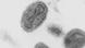 Smallpox under an electronic microscope Smallpox under an electronic microscope